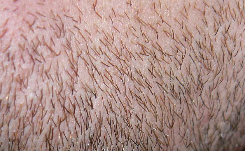 Body hair stubble can scrub your bed sheets and result in pilling.